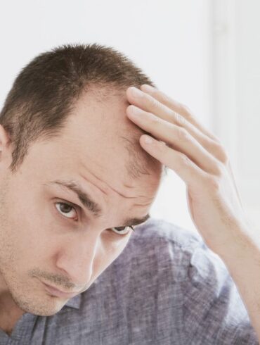 Ricrescita dei capelli. Migliori trattamenti anti caduta