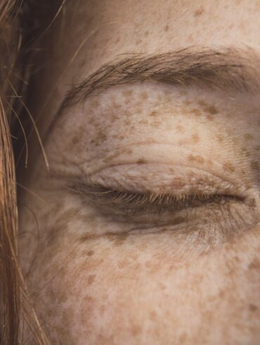 Come fare Lentiggini Finte: Consigli e Prodotti per realizzarle