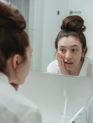 Prevenire l'acne: 5 consigli per il benessere della tua pelle